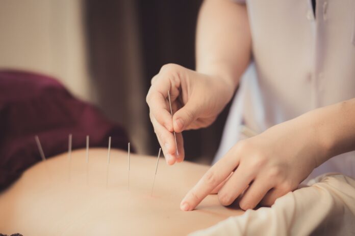 dry needling melbourne dry needling melbourne