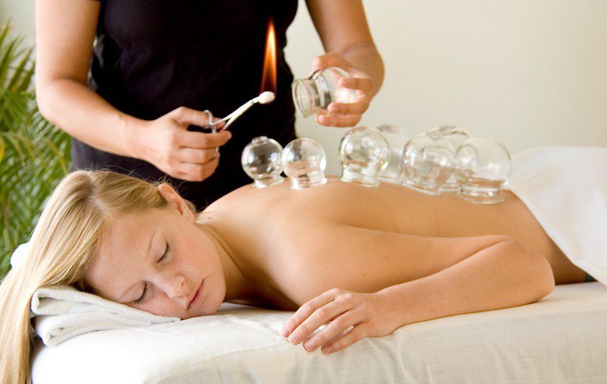 cupping therapy Melbourne