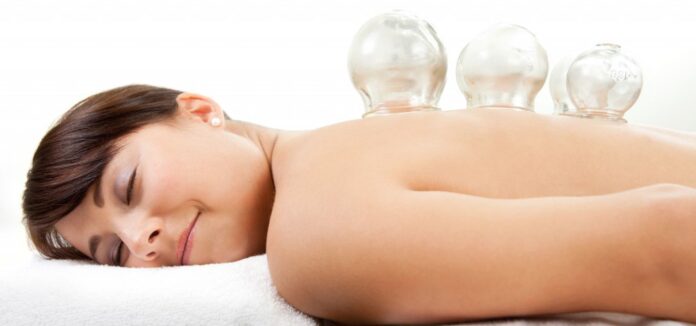 cupping therapy Melbourne cupping therapy Melbourne